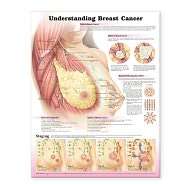Understanding Breast Cancer Anatomical Chart, (0781772222), Lippincott 