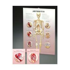  Arthritis Lenticular 3D Plastic Styrene Chart Industrial 