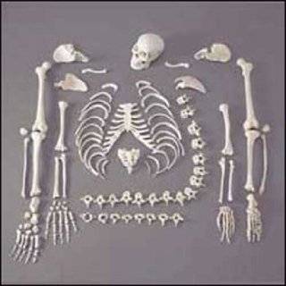 Anatomical Chart Co. Full Disarticulated Budget Skeleton With Skull 