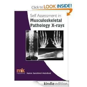 Self Assessment in Musculoskeletal Pathology X rays (Self assessment 