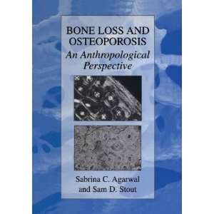  Bone Loss and Osteoporosis An Anthropological Perspective 