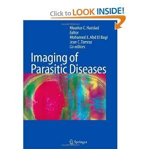  Imaging of Parasitic Diseases (9783642080456) Mohamed E 