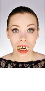 Vampire Teeth Upper & Lower Decayed Pointed dentures  